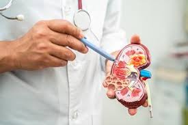 kidney specialist in Ludhiana