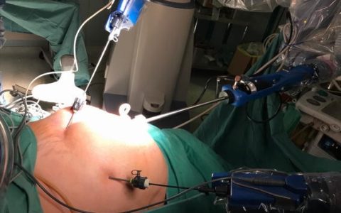 Robotic Uterus Removal Surgery in Mohali