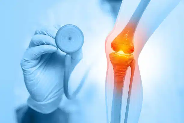 best knee replacement surgeon in Chandigarh