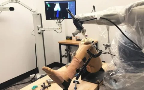 Robotic knee surgery in Mumbai