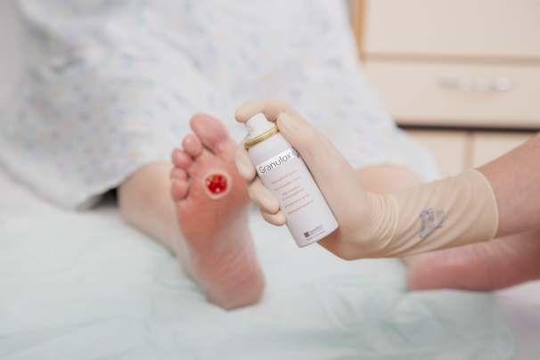 diabetic foot ulcer treatment near me