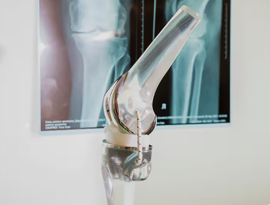 Best Knee Replacement Surgeon in Mumbai