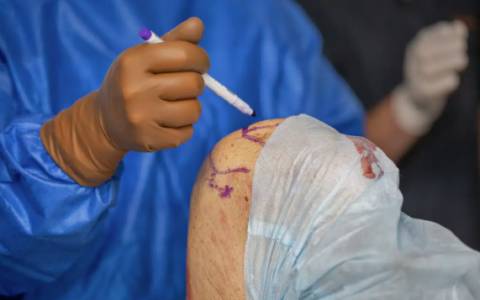 Best Knee Replacement Surgeon in Mumbai