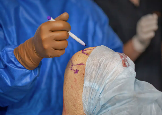 Best Knee Replacement Surgeon in Mumbai