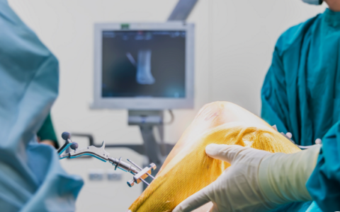 knee replacement surgery in Delhi