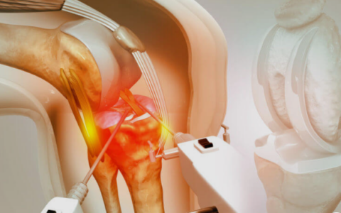 robotic knee replacement surgery in Chandigarh