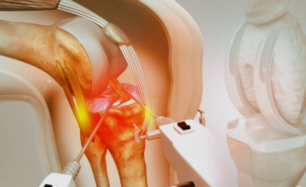 robotic knee replacement surgery in Chandigarh