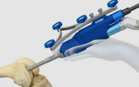 Robotic Knee Replacement Surgery in Chandigarh