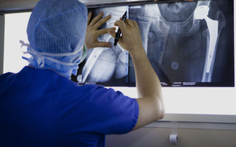 Revision hip replacement surgery in Chandigarh