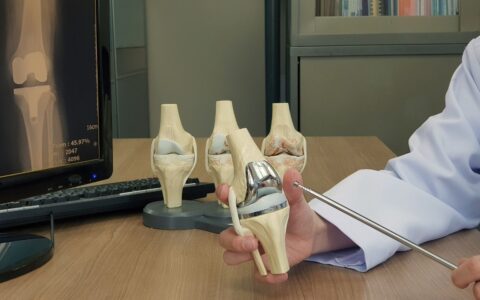 Robotic Knee Replacement in Chandigarh