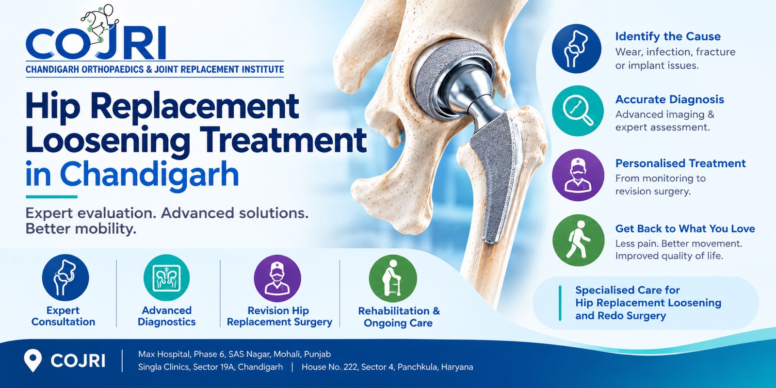 hip replacement loosening treatment Chandigarh